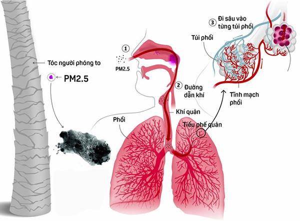 Bụi mịn PM2.5 và PM10 - Kẻ giết người vô hình